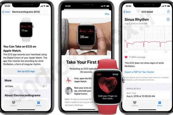 چگونه قابلیت ECG را به روی همه ریجن های اپل واچ فعال کنیم